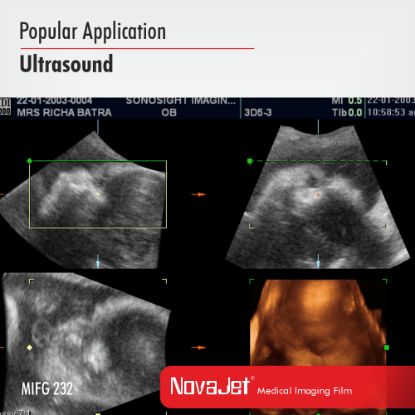Picture of NovaJet Medical Imaging Film Gloss 185-MIFG 232